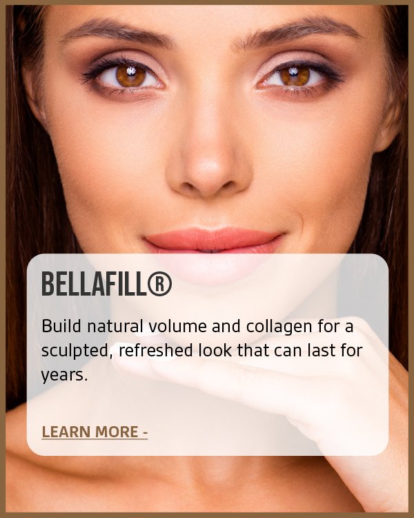 Close-up of a woman with brown eyes and makeup, smiling softly, with a promotional overlay for BELLA FILL skincare product about building natural volume and collagen.